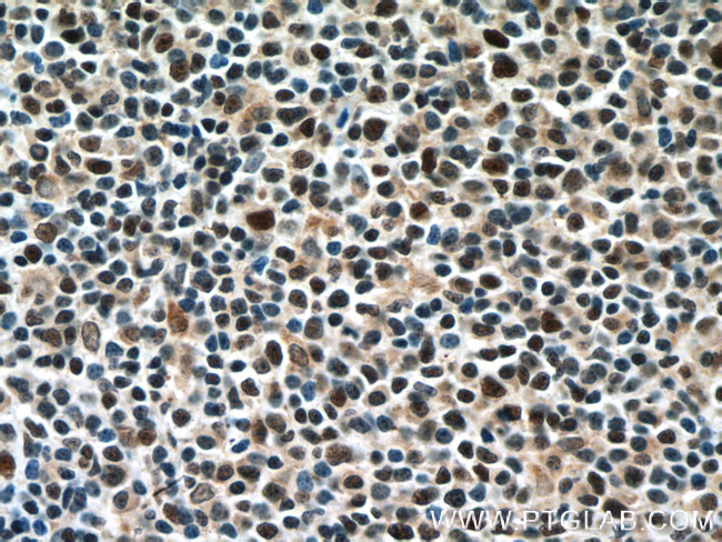 Prothymosin alpha Antibody in Immunohistochemistry (Paraffin) (IHC (P))