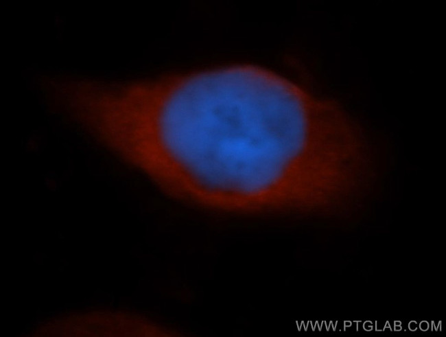 GAPDH Antibody in Immunocytochemistry (ICC/IF)