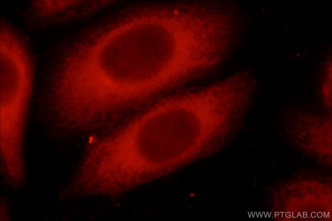 GAPDH Antibody in Immunocytochemistry (ICC/IF)