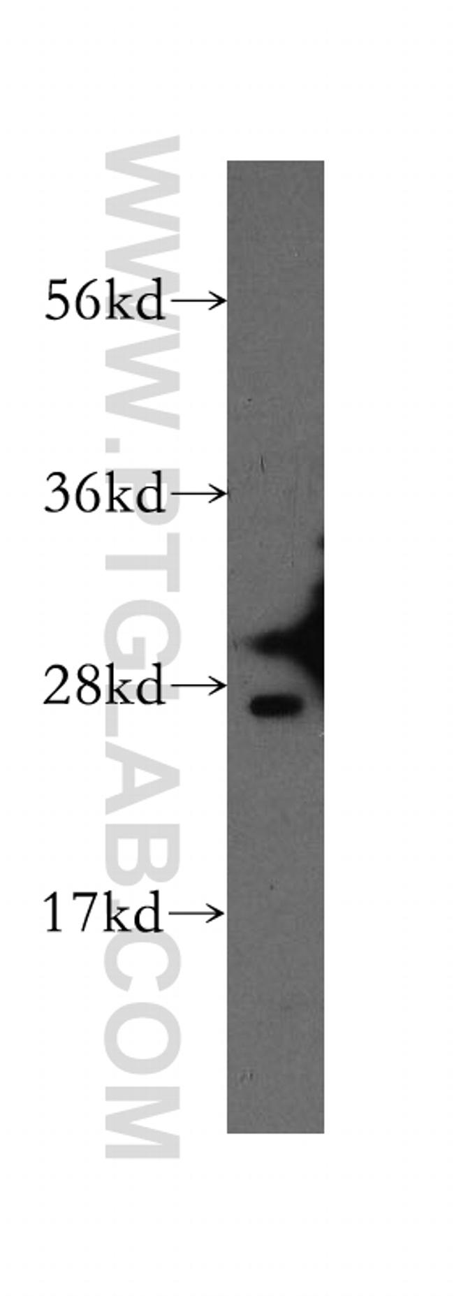GSTA2 Antibody in Western Blot (WB)