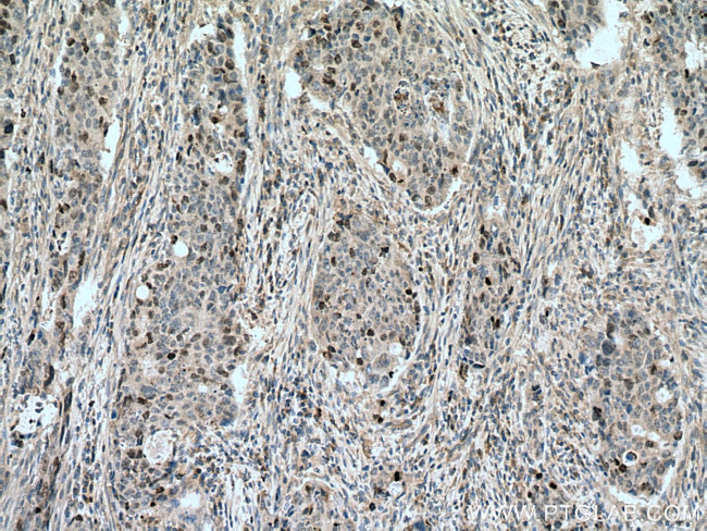 SURVIVIN Antibody in Immunohistochemistry (Paraffin) (IHC (P))