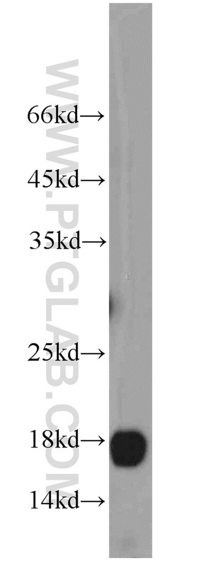 SURVIVIN Antibody in Western Blot (WB)