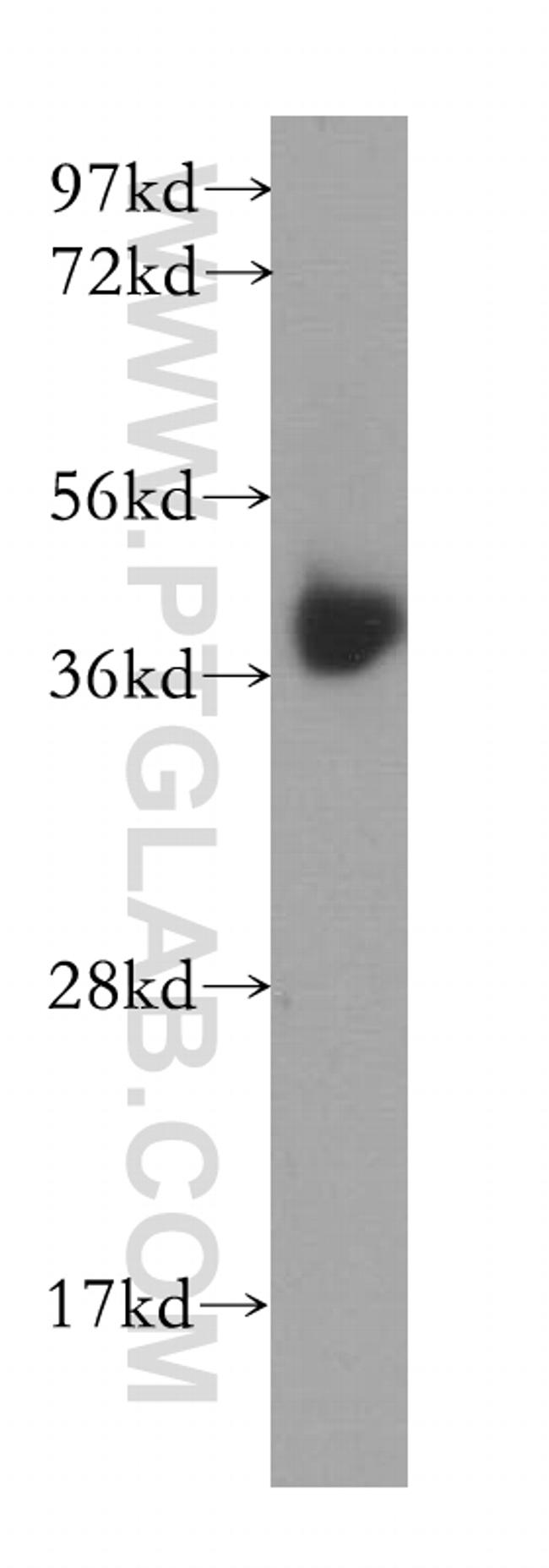 B4GALT7 Antibody in Western Blot (WB)