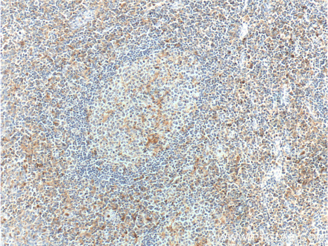 CD18 Antibody in Immunohistochemistry (Paraffin) (IHC (P))