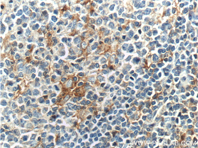 CD18 Antibody in Immunohistochemistry (Paraffin) (IHC (P))