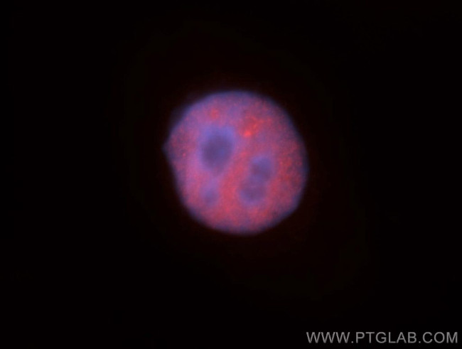 HNRNPUL1 Antibody in Immunocytochemistry (ICC/IF)