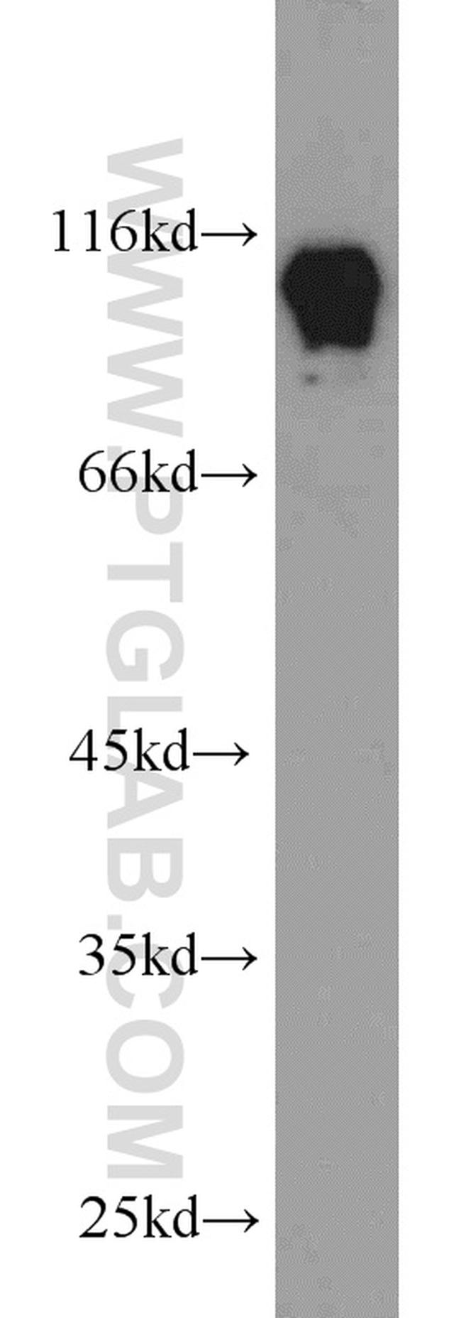 HNRNPUL1 Antibody in Western Blot (WB)