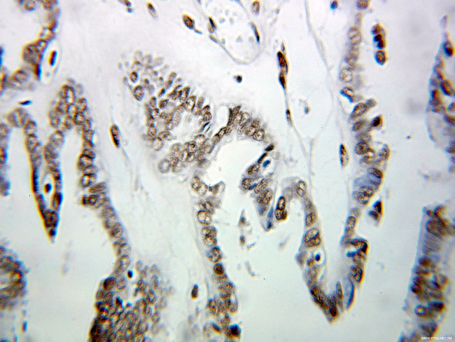 HNRNPUL1 Antibody in Immunohistochemistry (Paraffin) (IHC (P))