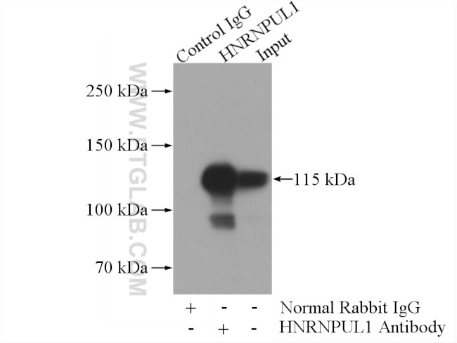 HNRNPUL1 Antibody in Immunoprecipitation (IP)