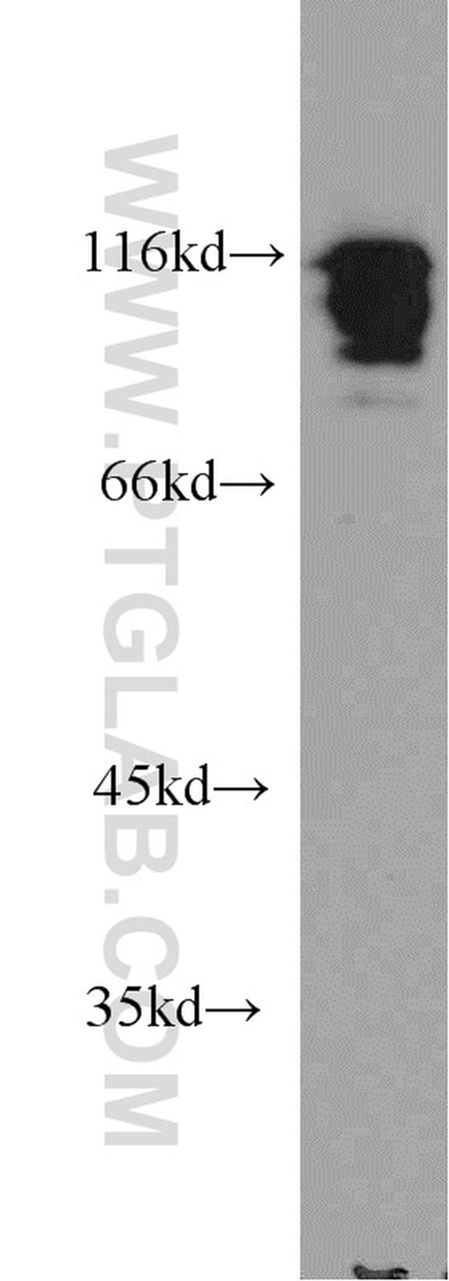 HNRNPUL1 Antibody in Western Blot (WB)