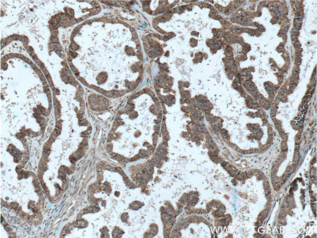 TRAPA/SSR1 Antibody in Immunohistochemistry (Paraffin) (IHC (P))