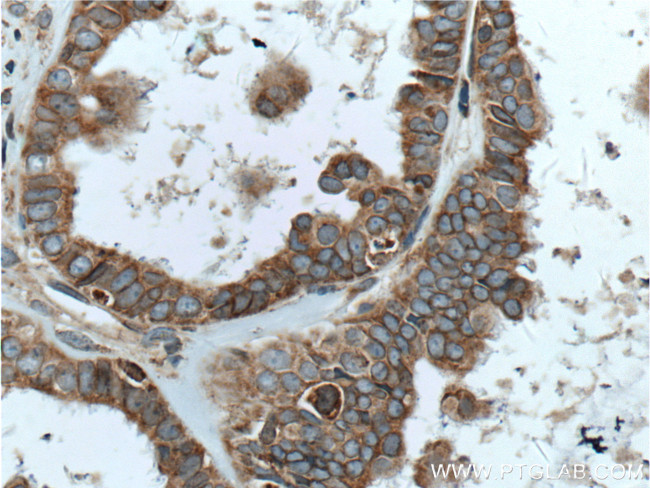 TRAPA/SSR1 Antibody in Immunohistochemistry (Paraffin) (IHC (P))