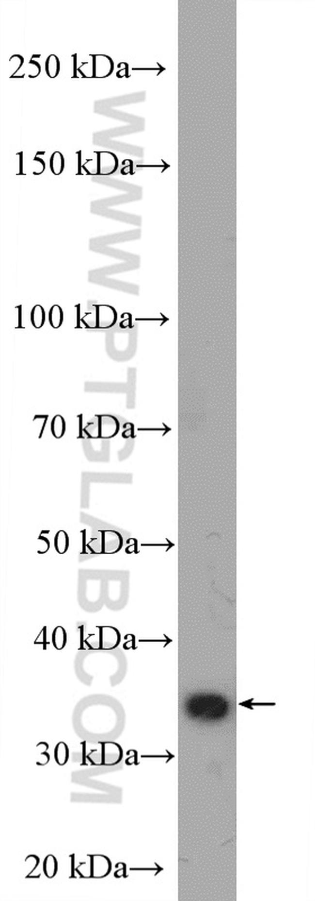 TRAPA/SSR1 Antibody in Western Blot (WB)