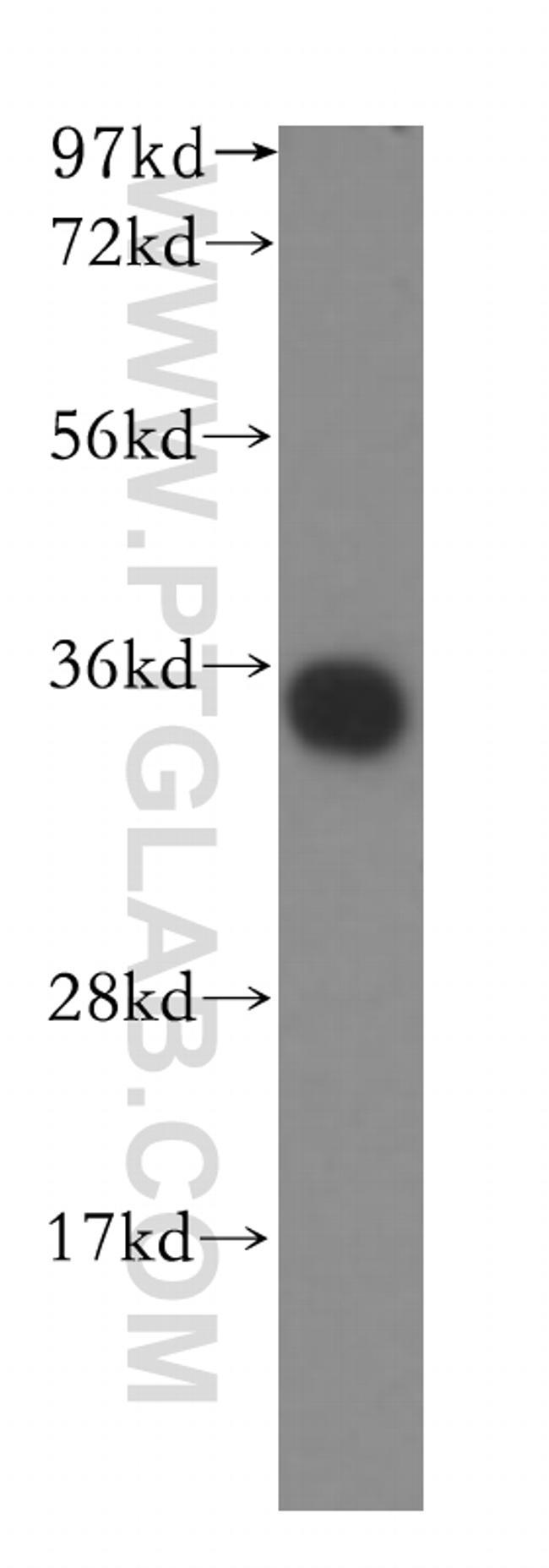 TRAPA/SSR1 Antibody in Western Blot (WB)