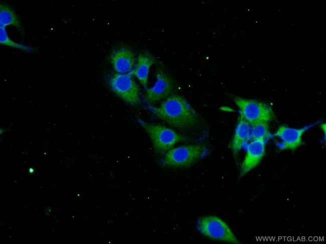 STMN2 Antibody in Immunocytochemistry (ICC/IF)