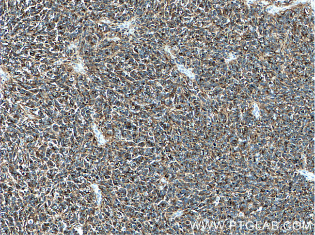 STMN2 Antibody in Immunohistochemistry (Paraffin) (IHC (P))