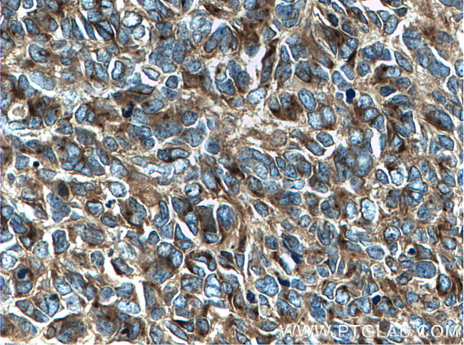 STMN2 Antibody in Immunohistochemistry (Paraffin) (IHC (P))