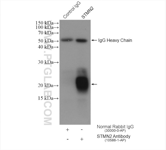 STMN2 Antibody in Immunoprecipitation (IP)