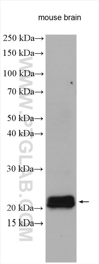 STMN2 Antibody in Western Blot (WB)