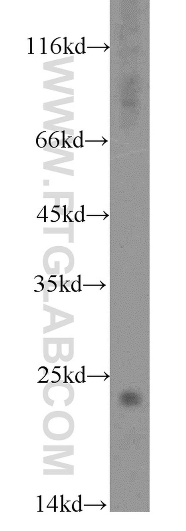 STMN2 Antibody in Western Blot (WB)