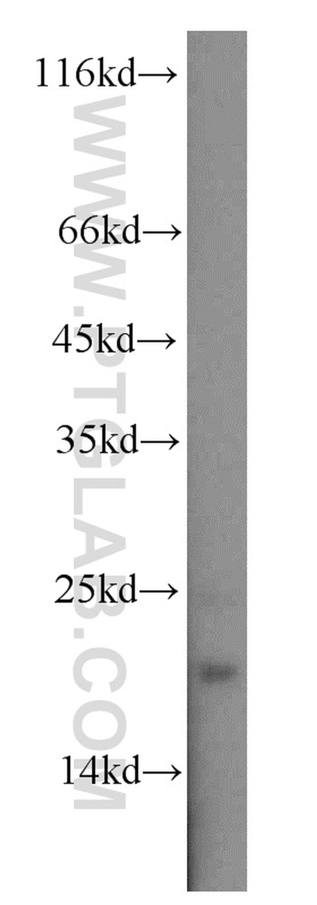 STMN2 Antibody in Western Blot (WB)