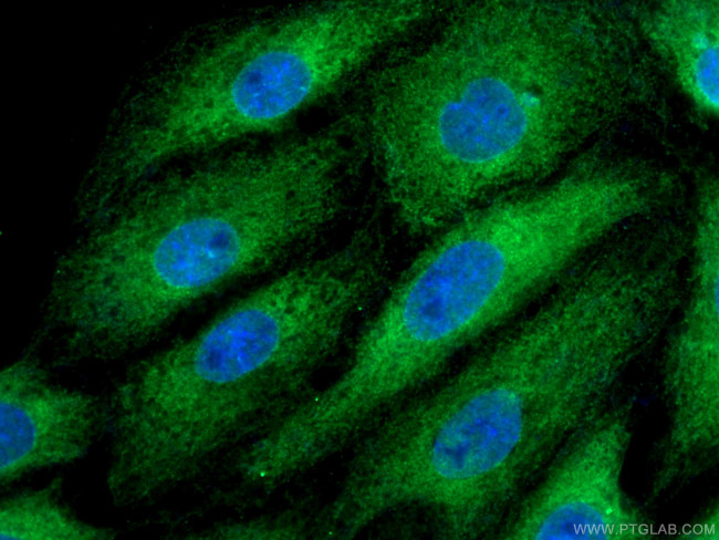 BAG3 Antibody in Immunocytochemistry (ICC/IF)