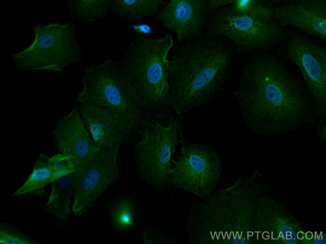 BAG3 Antibody in Immunocytochemistry (ICC/IF)