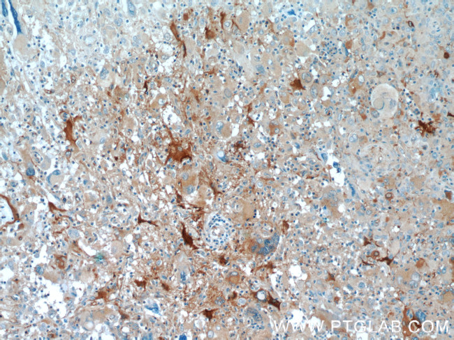 BAG3 Antibody in Immunohistochemistry (Paraffin) (IHC (P))