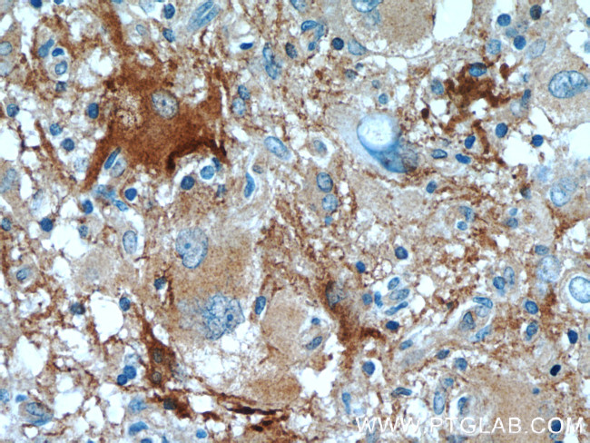 BAG3 Antibody in Immunohistochemistry (Paraffin) (IHC (P))