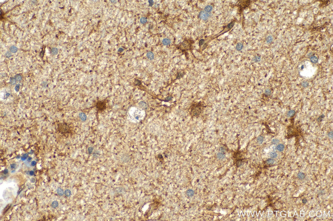 BAG3 Antibody in Immunohistochemistry (Paraffin) (IHC (P))