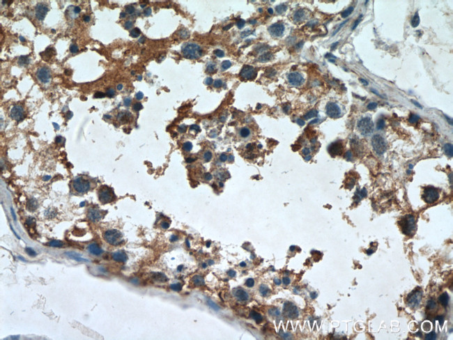 AGPAT1 Antibody in Immunohistochemistry (Paraffin) (IHC (P))