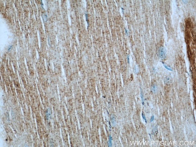 AGPAT1 Antibody in Immunohistochemistry (Paraffin) (IHC (P))