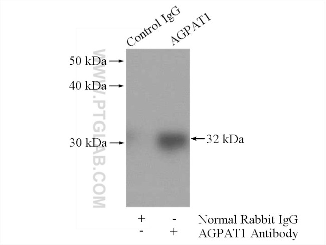 AGPAT1 Antibody in Immunoprecipitation (IP)