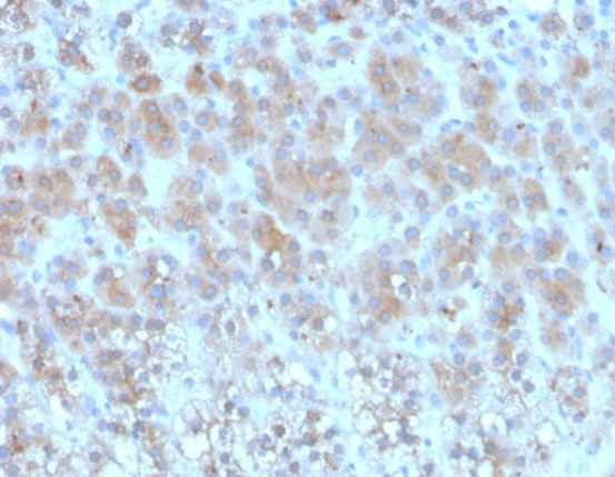 Periostin (POSTN) Antibody in Immunohistochemistry (Paraffin) (IHC (P))