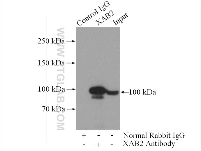 XAB2 Antibody in Immunoprecipitation (IP)