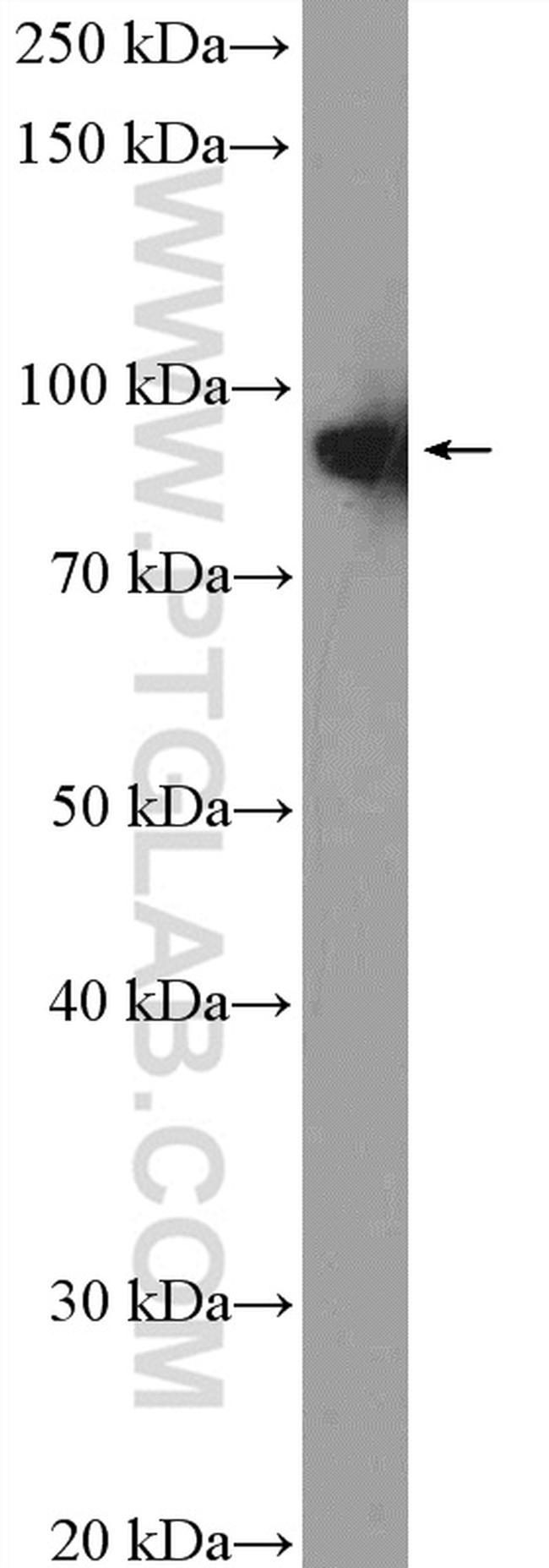 XAB2 Antibody in Western Blot (WB)