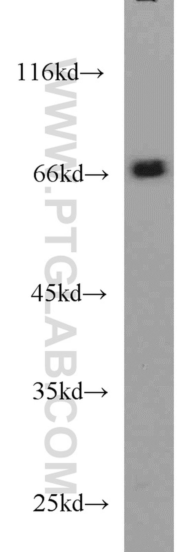 TDP1 Antibody in Western Blot (WB)