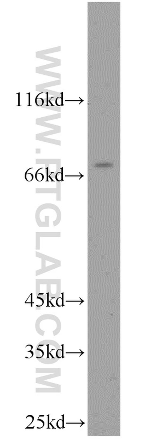 DPP3 Antibody in Western Blot (WB)