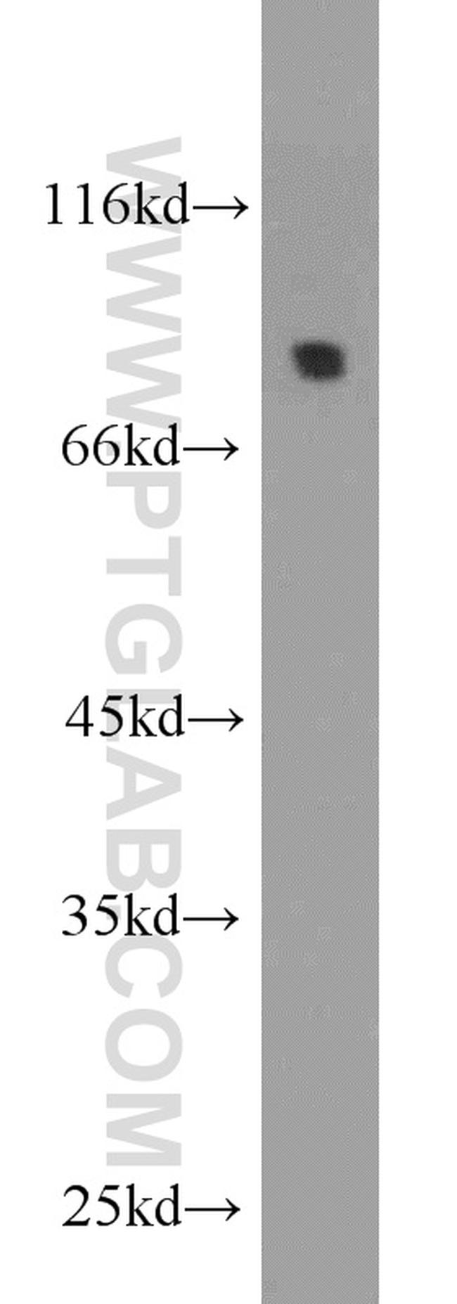 DPP3 Antibody in Western Blot (WB)