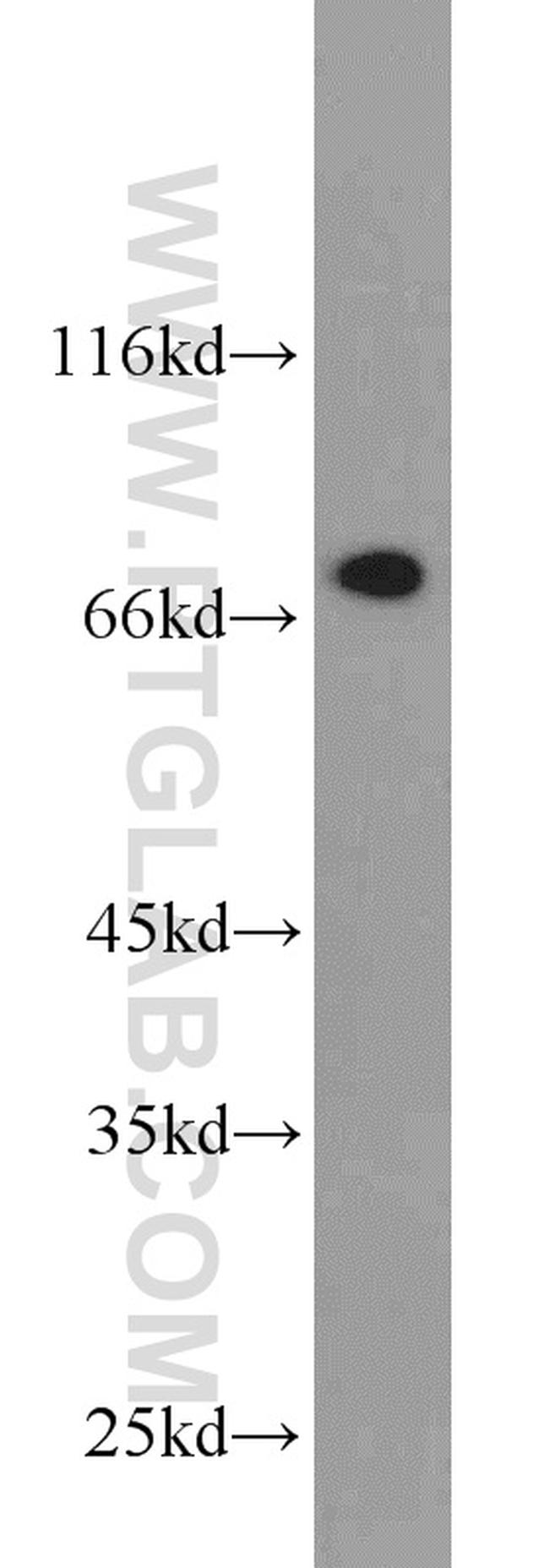 DPP3 Antibody in Western Blot (WB)