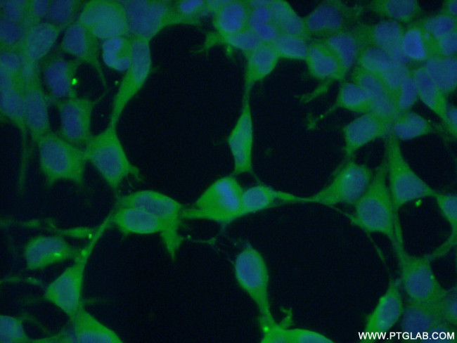 Hsc70 Antibody in Immunocytochemistry (ICC/IF)