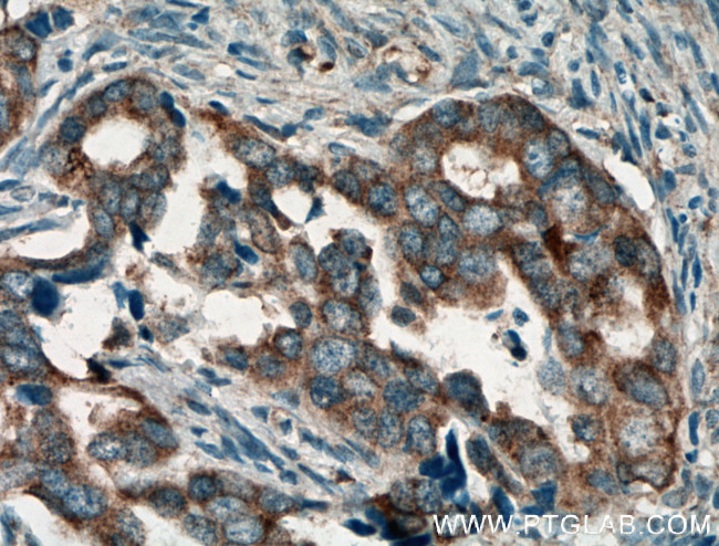 Hsc70 Antibody in Immunohistochemistry (Paraffin) (IHC (P))