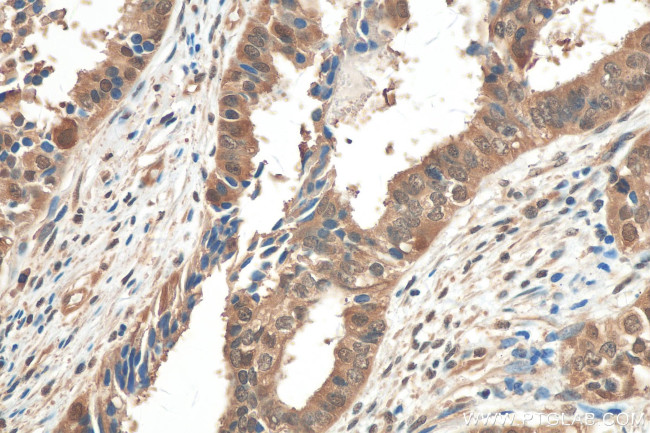 Hsc70 Antibody in Immunohistochemistry (Paraffin) (IHC (P))