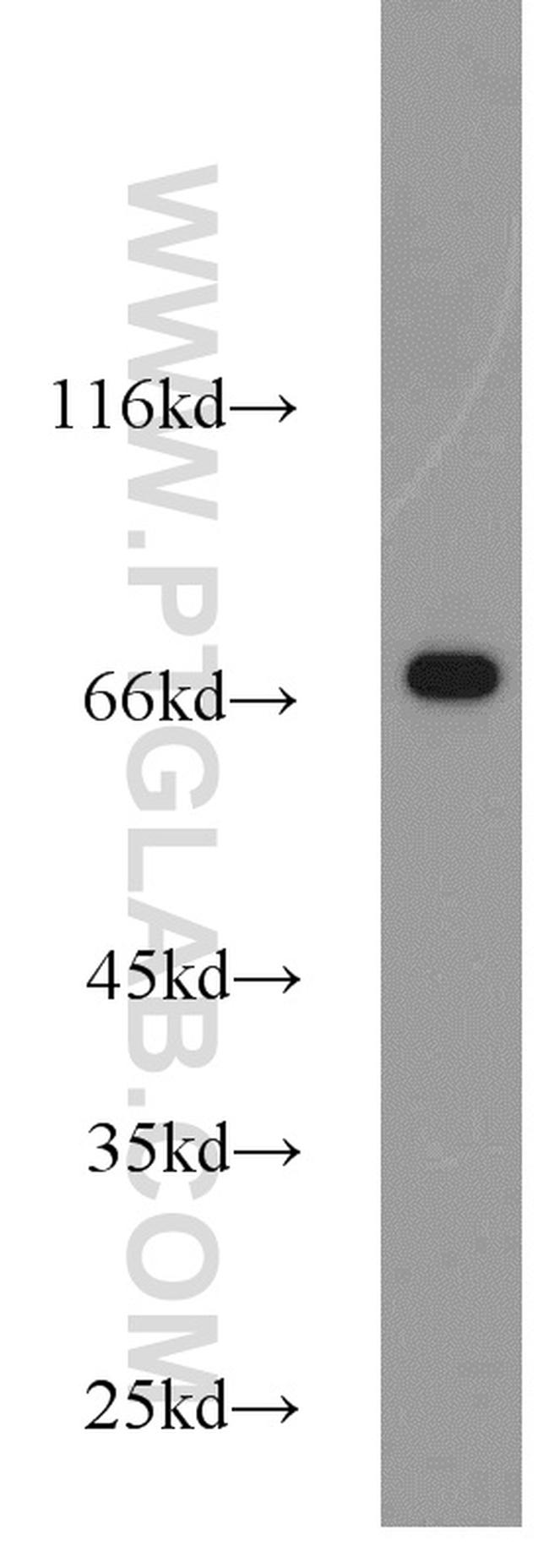 Hsc70 Antibody in Western Blot (WB)