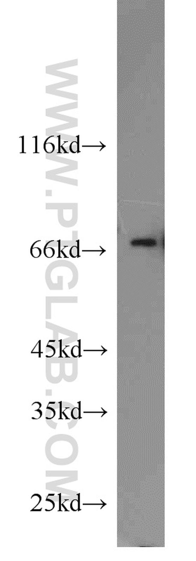 Hsc70 Antibody in Western Blot (WB)