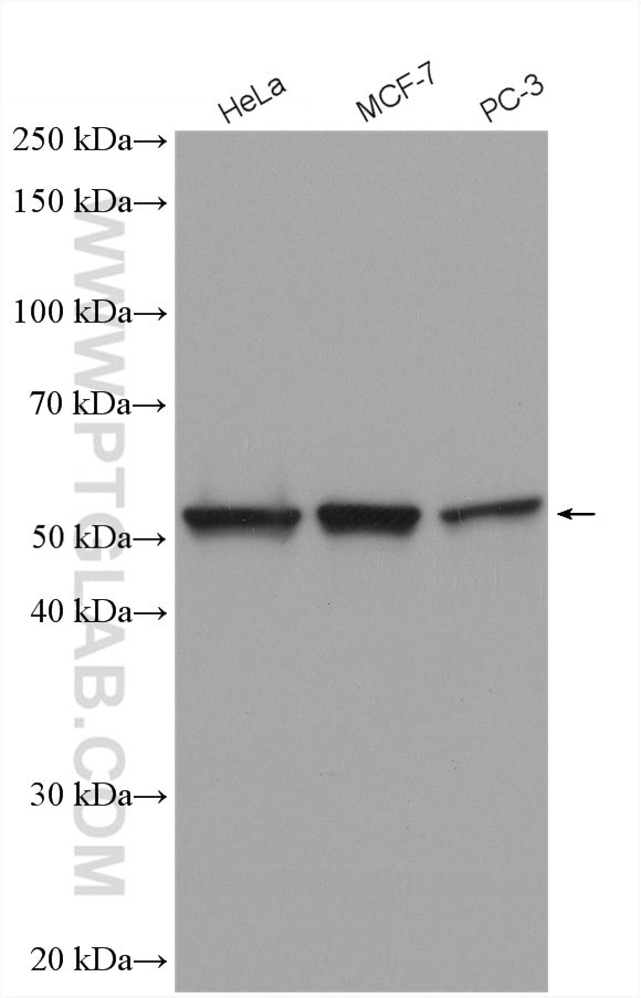 FKBP52 Antibody in Western Blot (WB)