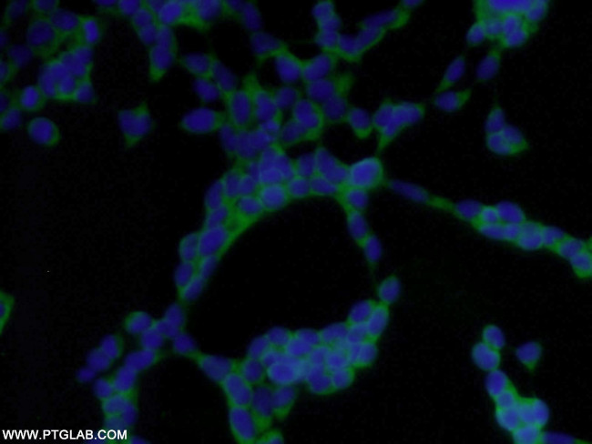 NUDC Antibody in Immunocytochemistry (ICC/IF)