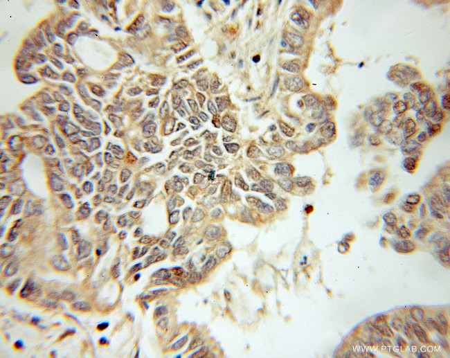 NUDC Antibody in Immunohistochemistry (Paraffin) (IHC (P))