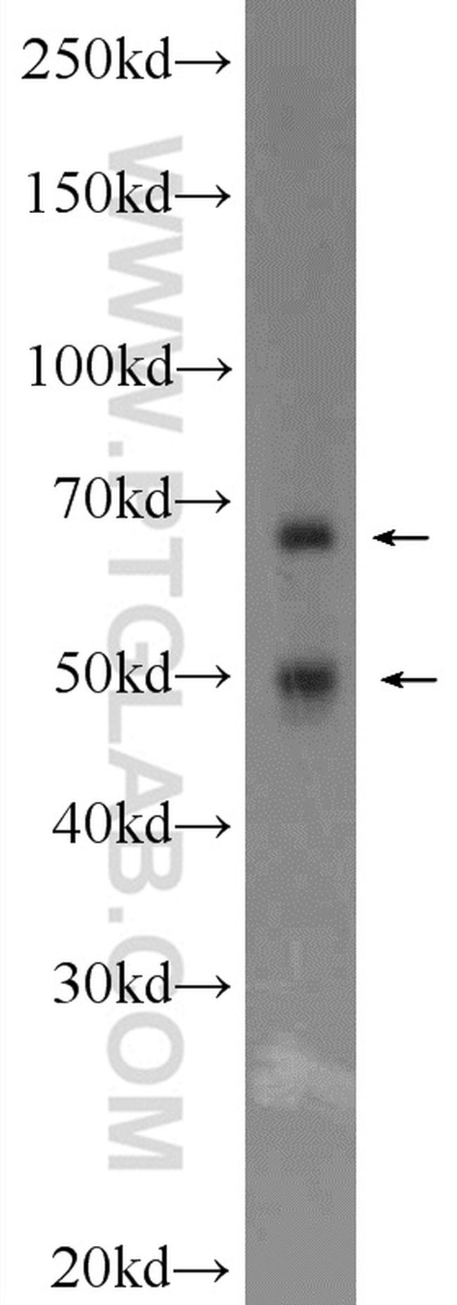 CDC23 Antibody in Western Blot (WB)