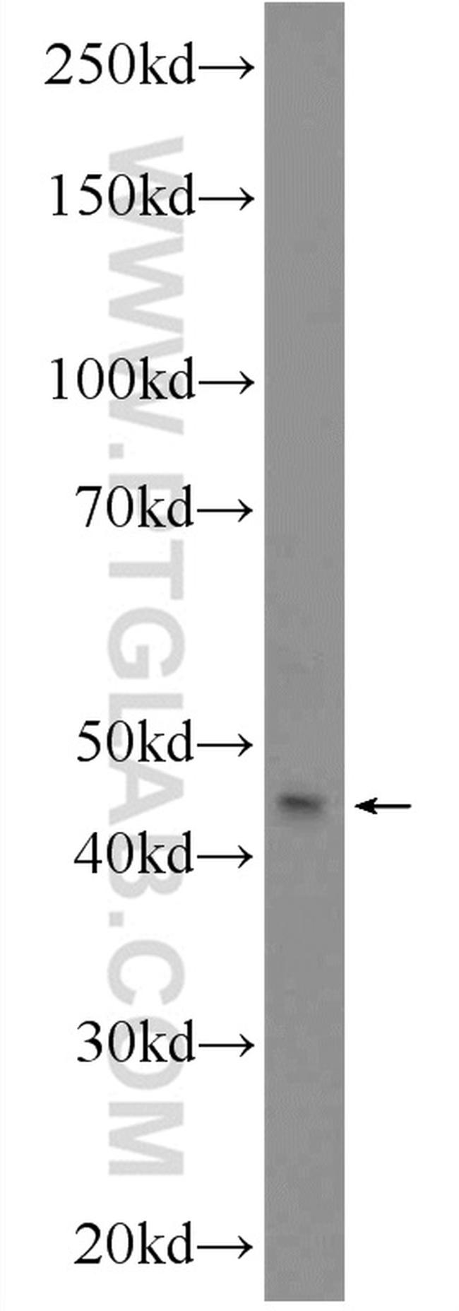 CDC23 Antibody in Western Blot (WB)